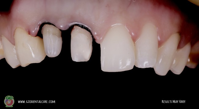 get-your-smile-here--1